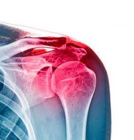 курс по артроскопії плечового суглоба