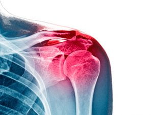 курс по артроскопії плечового суглоба